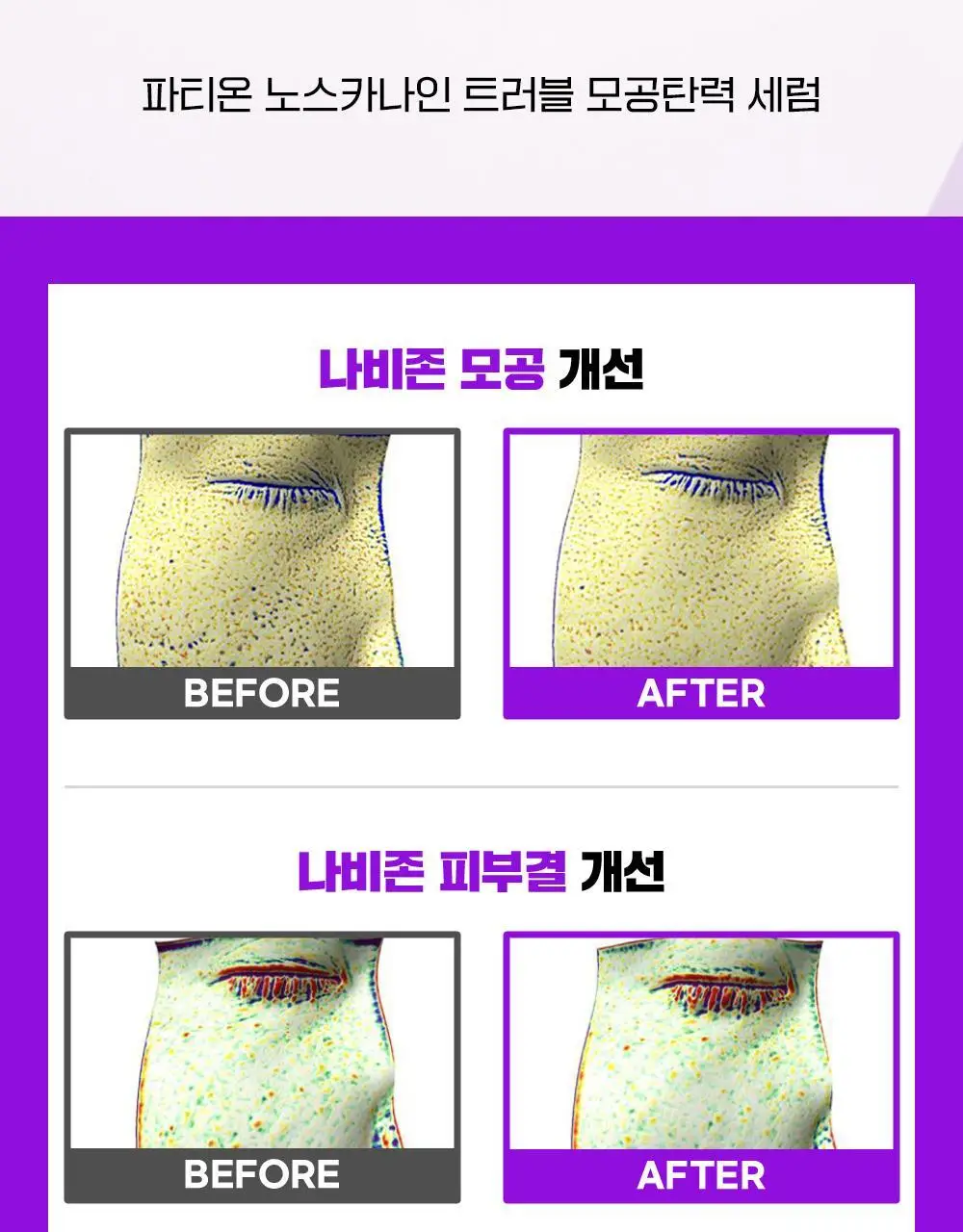 [단독기획/대용량] 파티온 노스카나인 트러블 모공탄력 세럼 50ml 기획(+5ml+크림 5ml) 상세페이지 3